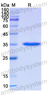 Recombinant Human E2F2 Protein, N-His