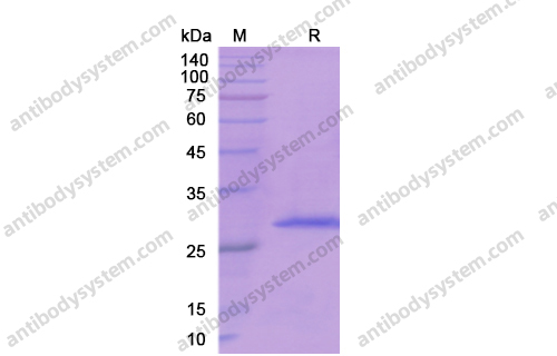 Recombinant Human EBI3/IL27B Protein, N-His