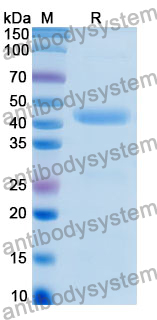Recombinant Human EIF4A2 Protein, N-His