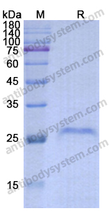 Recombinant Human ADGRE1/EMR1 Protein, N-His
