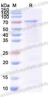 Recombinant Human CTTN Protein, N-His