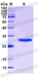 Recombinant Human FLNC Protein, N-His