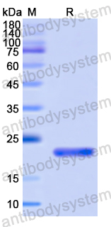 Recombinant Human GAMT Protein, N-His