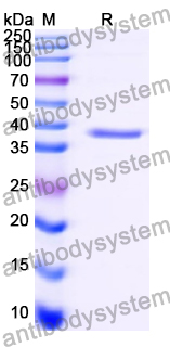 Recombinant Human BECN1 Protein, N-His