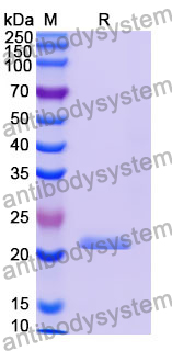 Recombinant Human WFDC2/WAP5 Protein, N-His-SUMO