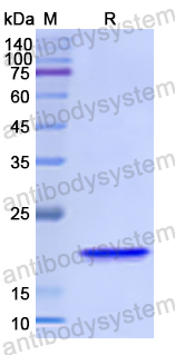 Recombinant Human KRT81 Protein, N-His