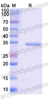 Recombinant Human SEMA3A Protein, N-His