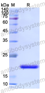 Recombinant Human IHH Protein, N-His
