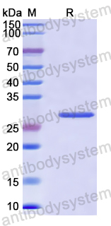 Recombinant Human ITIH4 Protein, N-His
