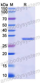 Recombinant Human IL11RA Protein, N-His