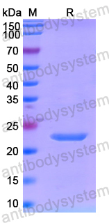 Recombinant Human GSE1 Protein, N-His-SUMO & C-Strep