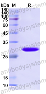 Recombinant Human RFTN1 Protein, N-His