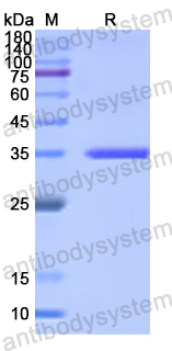 Recombinant Human GNMT Protein, N-His