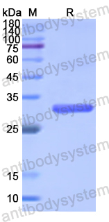 Recombinant Human MVP Protein, N-His