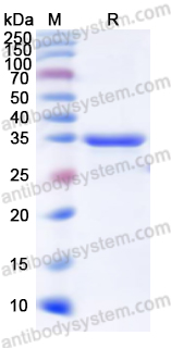 Recombinant Human LTBP2 Protein, N-His