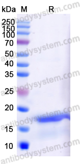 Recombinant Human GOLGB1/Giantin protein,N-His