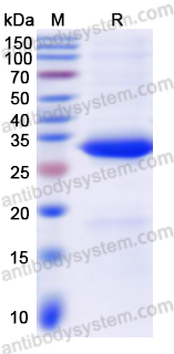 Recombinant Human CASP8 Protein, N-His