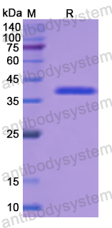 Recombinant Human MYBPC3 Protein, N-His