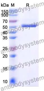 Recombinant Human MYBPC3 Protein, N-His