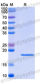 Recombinant Human SLC17A1 Protein, N-His-SUMO