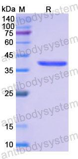 Recombinant Human SLC10A1 Protein, N-His