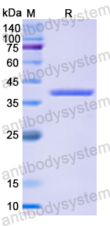 Recombinant Human NUMA1/NMP-22 Protein, N-His