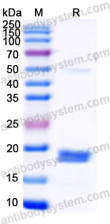 Recombinant Human NUMA1/NMP-22 Protein, N-His