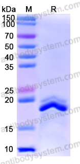 Recombinant Human WTAP Protein, N-His
