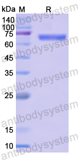 Recombinant Human PSMD6 Protein, N-GST