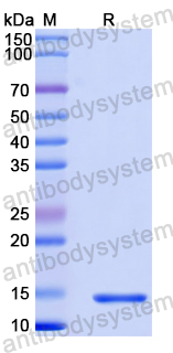 Recombinant Human SUZ12 Protein, N-His