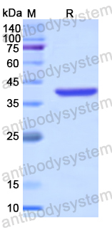 Recombinant Human SETDB1 Protein, N-His