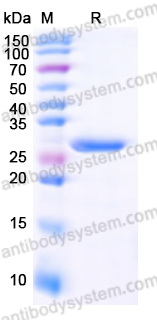 Recombinant Human POSTN Protein, N-His