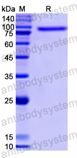 Recombinant Human POSTN Protein, N-His