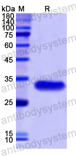 Recombinant Human ANKRD1 Protein, N-His