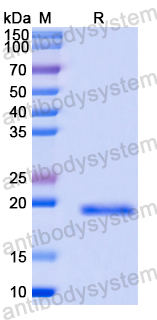 Recombinant Human PCBP1 Protein, N-His