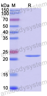 Recombinant Human RHEB Protein, N-His