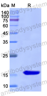 Recombinant Human ANGPT1 Protein, N-His