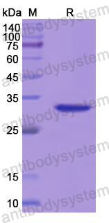 Recombinant Human RPS6KA1 Protein, N-His