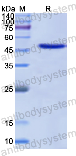 Recombinant Human CYTH1 Protein, N-His