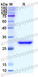 Recombinant Human FCN2 Protein, N-His