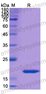 Recombinant Human SPA17 Protein, N-His