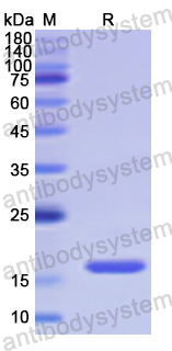 Recombinant Human TAF13 Protein, N-His