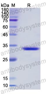 Recombinant Human TERF2 Protein, N-His