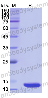Recombinant Human TGIF1 Protein, N-His