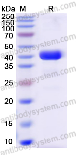 Recombinant Human SLC9A3R2 Protein, N-His