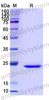 Recombinant Human DIXDC1 Protein, N-His