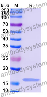 Recombinant Human TRIP11 Protein, N-His