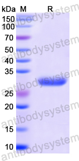 Recombinant Human OASL Protein, N-His