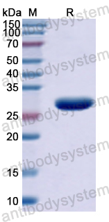Recombinant Human NFKBIB Protein, N-His