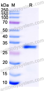 Recombinant Human TPSAB1/Tryptase-1 Protein, N-His